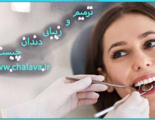 ترمیم وزیبایی دندان