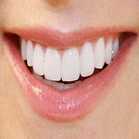 روش های ترمیم و زیبایی دندان 