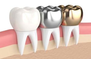 روش های ترمیم و زیبایی دندان 