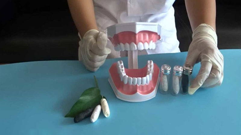 چه موادی در هنگام روکش دندان ها استفاده می شود؟