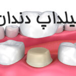 بیلداپ