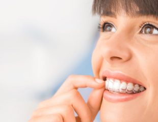 اینویزیلاین