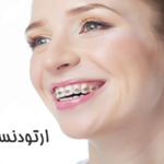 ارتودنسی ثابت