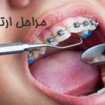 مراحل ارتودنسی