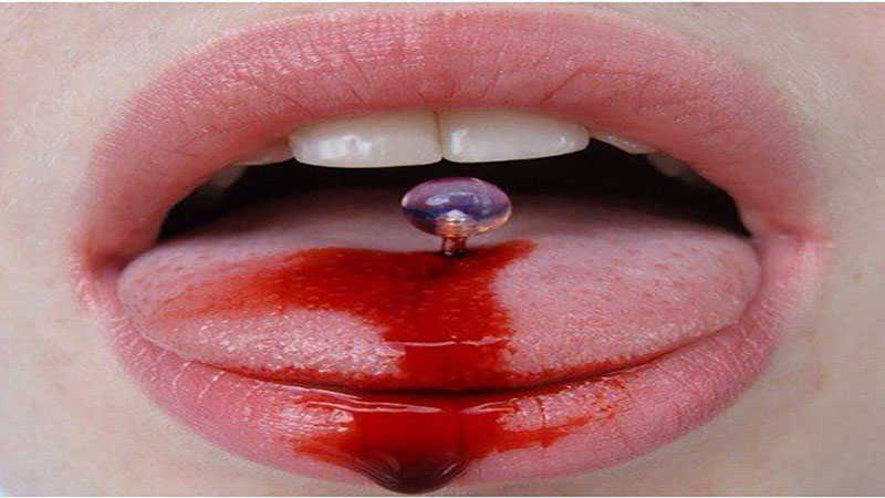 خونریزی پیرسینگ زبان