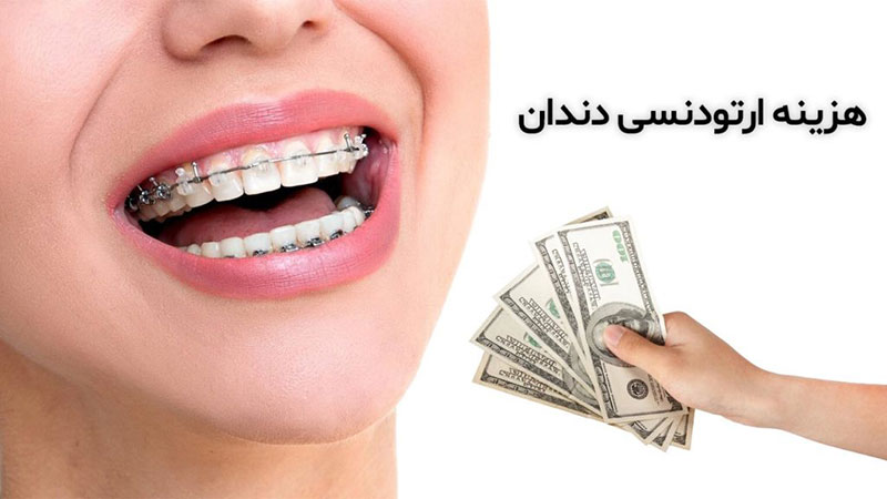 هزینه ارتودنسی