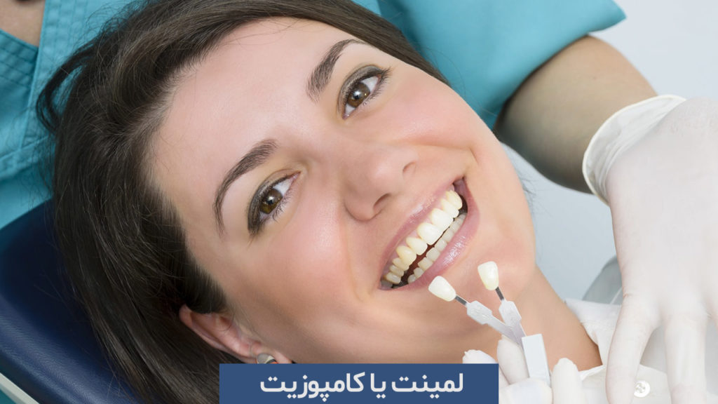 لمینت یا کامپوزیت