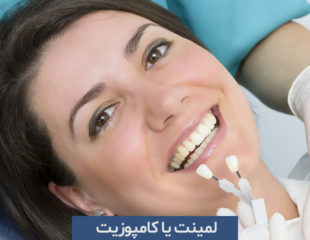 لمینت یا کامپوزیت