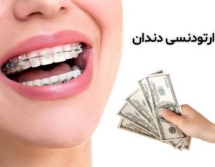هزینه ارتودنسی دندان